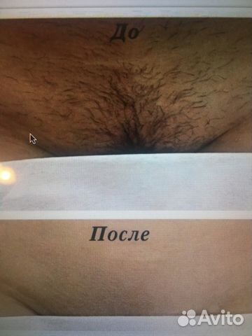 Шугаринг,воск,Фотоэпил,чистка лица,ресницы,брови Шугаринг,воск,Фотоэпил,чистка лица,ресницы,брови